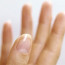 Заболевания ногтей: правда и мифы