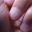 Ногти слоятся и ломаются: причины данного недуга