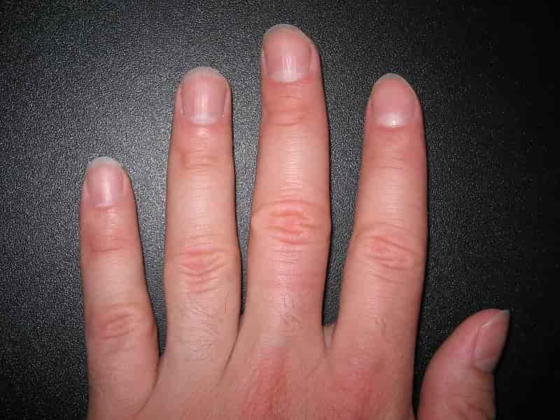 Белые полукруги у основания здоровых ногтей