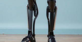 Протезирование ног: новые горизонты в жизни и движении