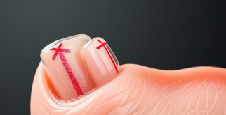Die Anatomie des Nagels: Geheimnisse von Aufbau, Wachstum und Pflege