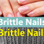 Brüchige Nägel: Ursachen, Behandlung und praktische Pflegetipps für starke Hände