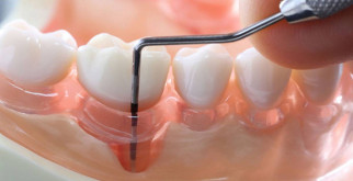 Мадагаскарские палочники: волшебство природы в каждом шаге