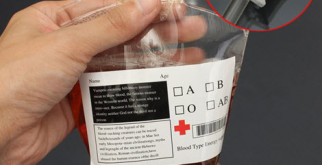 Эффективность капельницы от алкогольной зависимости