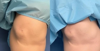 Лабиопластика в Киеве: эстетика и здоровье женщины