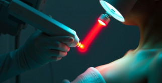 Лазерная эпиляция: путь к гладкой коже без лишних забот