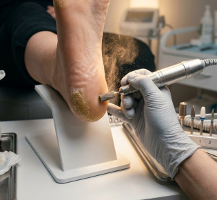 Аппаратный педикюр при трещинах и гиперкератозе