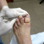 Лечение после удаления ногтя с грибком
