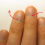 Почему на ногтях появляются белые пятна: основные причины заболевания