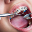 Особенности ортодонтии
