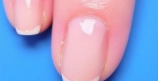 Comment rattraper un ongle cassé ? Le guide complet pour réparer, protéger et retrouver de beaux ongles