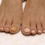 Дистрофия ногтя: причины дистрофии ногтей на руках и ногах и лечение народными средствами